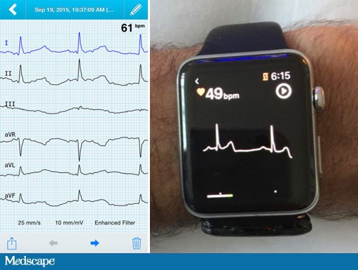 Smart Watch Color Screen Smartwatch ECG+PPG Heart Rate