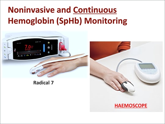 Blood Management In Critical Care: Role Of Continuous Hemoglobin ...