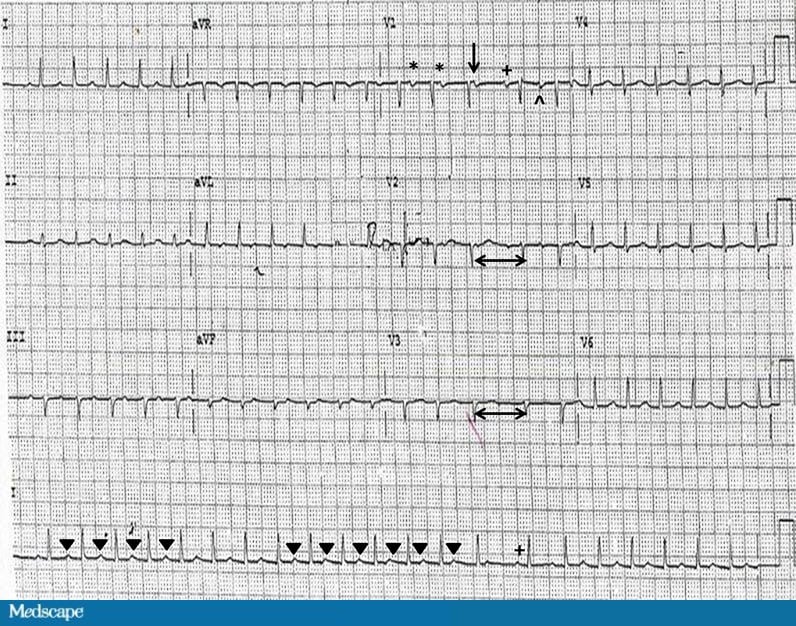 ECG Challenge: Evaluate This Rapid Rate - Page 2