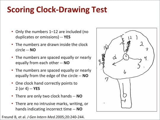 moca scoring on clock hands