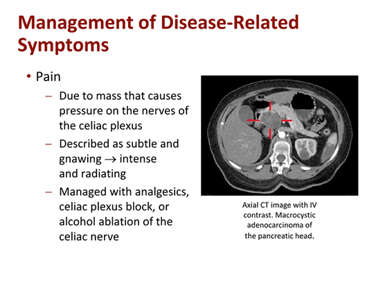Management of Advanced Pancreatic Adenocarcinoma: The Nurse View ...