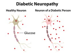 Fast Five Quiz: Diabetic Neuropathy - Page 3