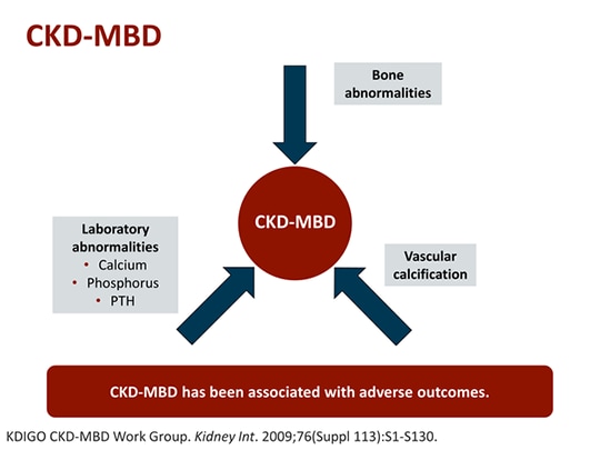 Key Concepts In Ckd Mbd Essentials For Improving Outcomes Transcript