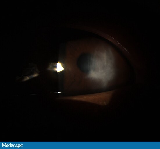 A Cloudy and Painful Eye Page 3