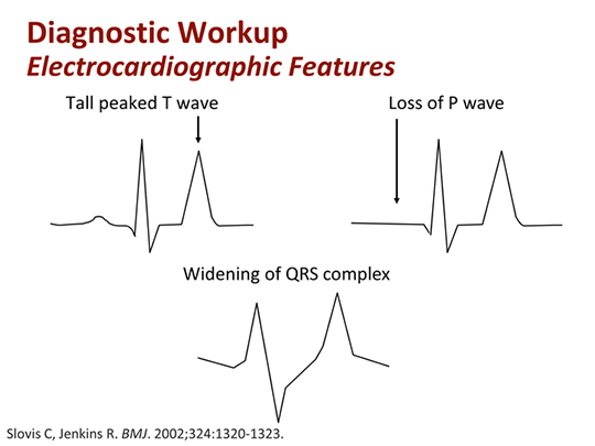 New Therapies for Hyperkalemia Across the Continuum of Care (Transcript)