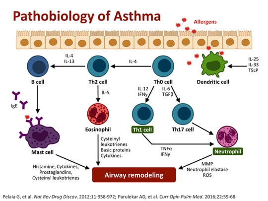 Moderate-to-Severe Asthma Management: Focus on Control-Based Strategies ...