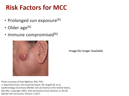 Merkel Cell Carcinoma: What Do Clinicians Need to Know ...