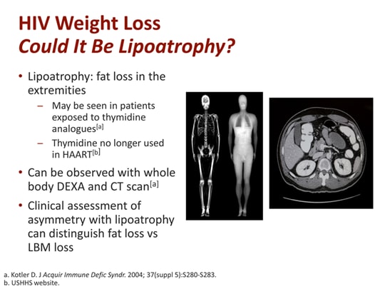 hiv-associated-weight-loss-and-wasting-addressing-an-ongoing-burden