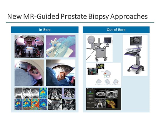 Strategies for Improving Diagnosis and Risk Stratification in Prostate ...