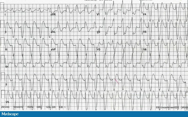 ECG Challenge Mid Fifties And Feeling Faint ecg-challenge-mid-fifties-and-feeling-faint