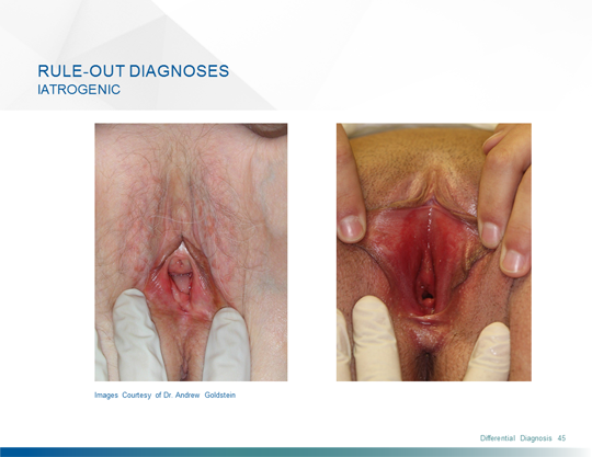vaginal discomfort Physical labia clitoris