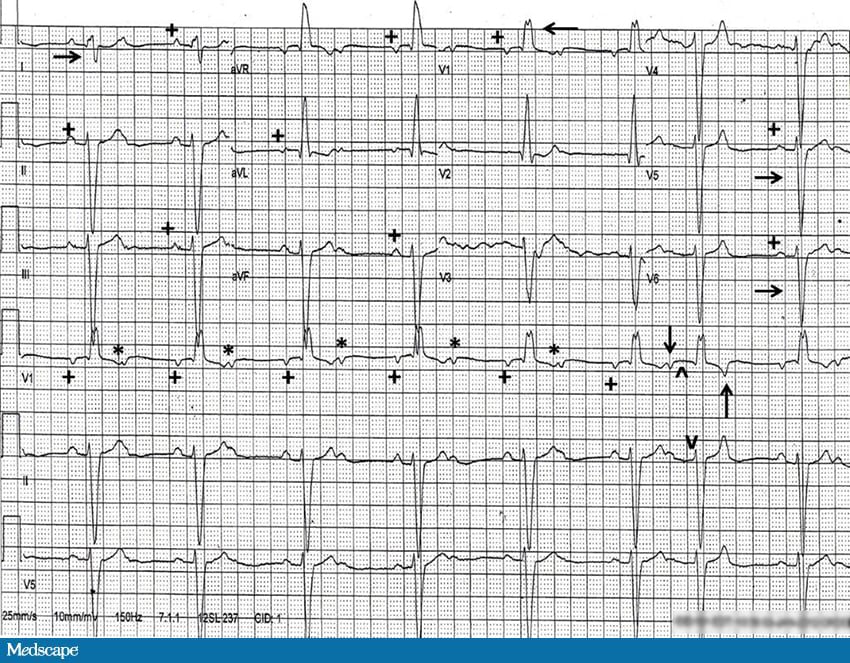 ECG Challenge: While He Was Sleeping… - Page 2