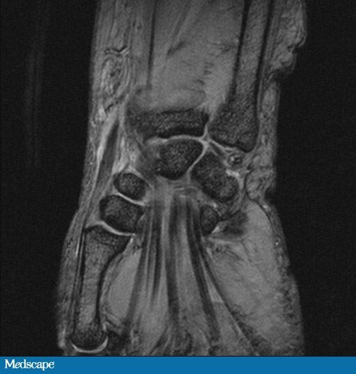 Wrist Pain After Pregnancy in a 31YearOld Woman Page 2