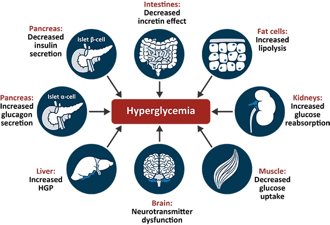 Pharmacologically Treating the Brain in Diabetes: Clinical FAQs Answered