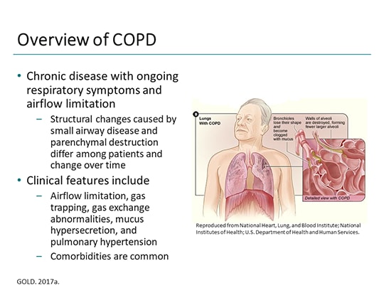 Non Invasive Ventilation COPD