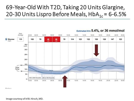 Using the AGP to Standardize Glucose Reporting: The Future of CGM