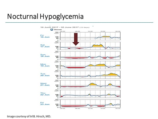Using the AGP to Standardize Glucose Reporting: The Future of CGM