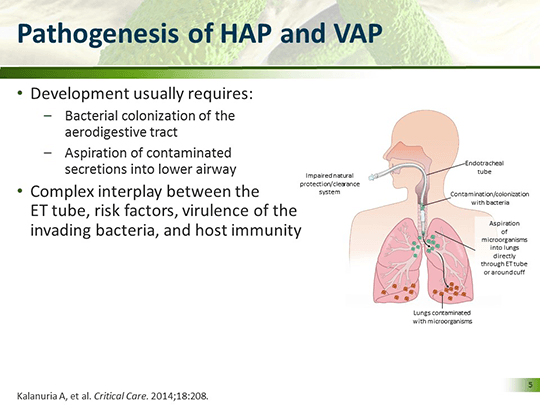 elfbar elfa kaufen Advances in the Treatment of Gram-Negative Pneumonia: From Drugs to Devices  (Transcript)