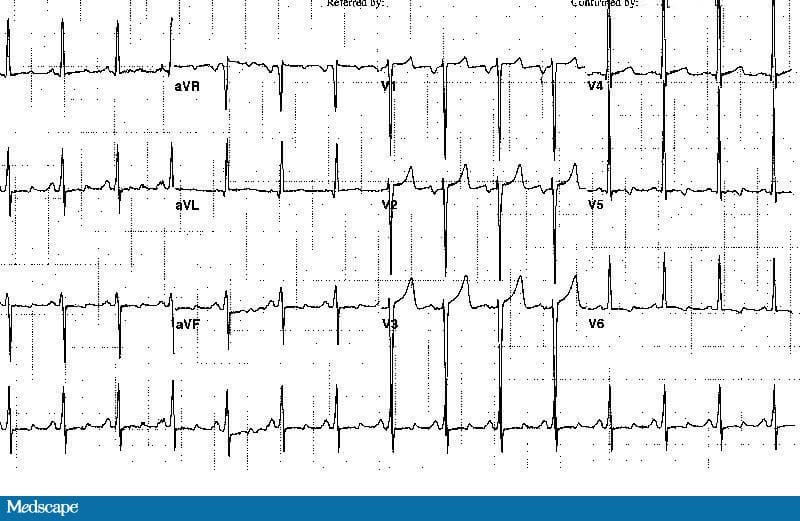 A 52-Year-Old Man With Blurred Vision and Headache - Page 2