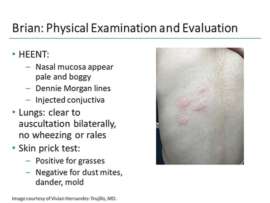 Seasonal Allergic Rhinitis: Guideline Updates Applied to Clinical Cases