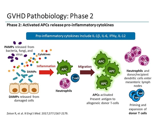 The JAK-STAT Pathway and Graft-vs-Host Disease (Transcript)