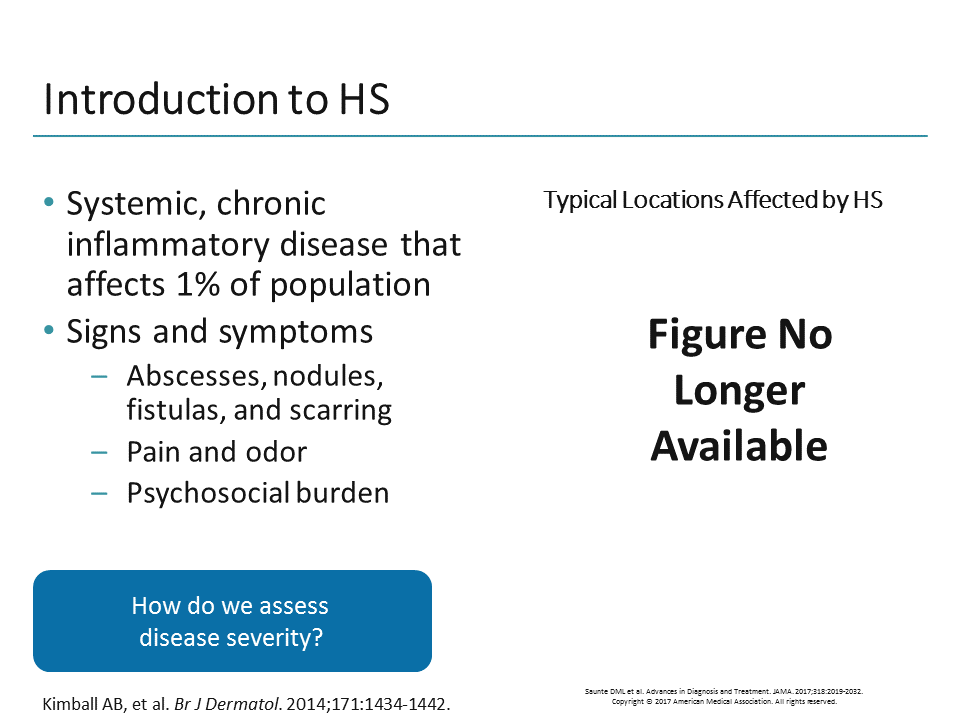 New Recommendations On How To Stage Hidradenitis Suppurativa (Transcript)