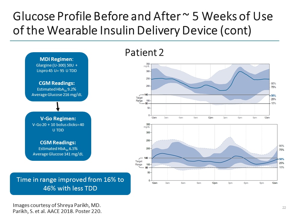 Simplifying Insulin Delivery for Better Patient in T2D