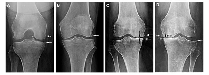 Case Challenges: Patients With Joint Pain