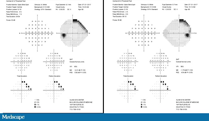 field involving grids but not clues