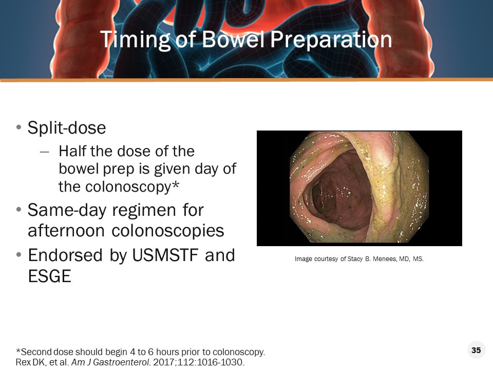 Optimizing Colonoscopy Outcomes Through Quality Bowel Prep Transcript