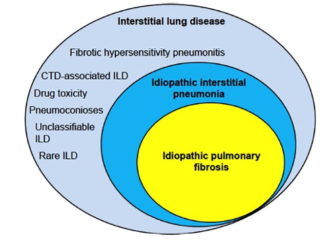 Progressive Fibrosing Interstitial Lung Diseases: Different Diagnoses ...