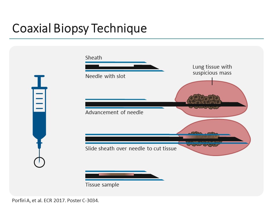 Optimizing Characterization of NSCLC Through Specialty Collaboration ...