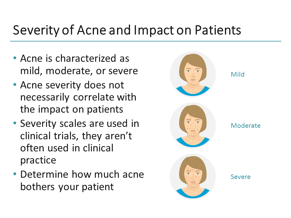 The Acne Landscape Is Evolving: Here's What You Need to Know