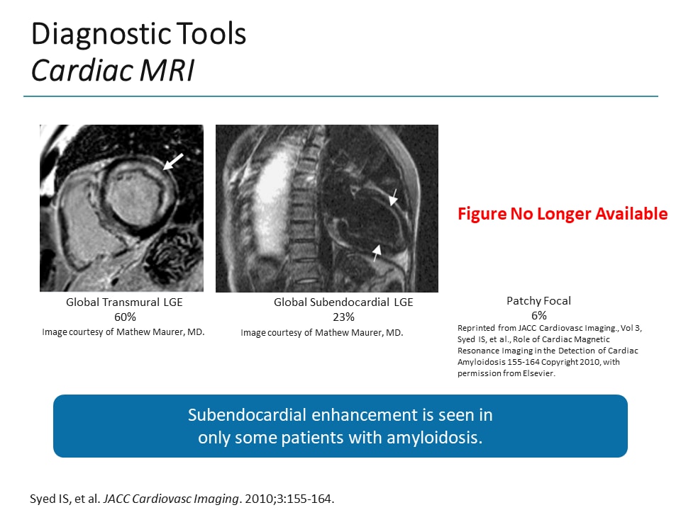 Slide 13.