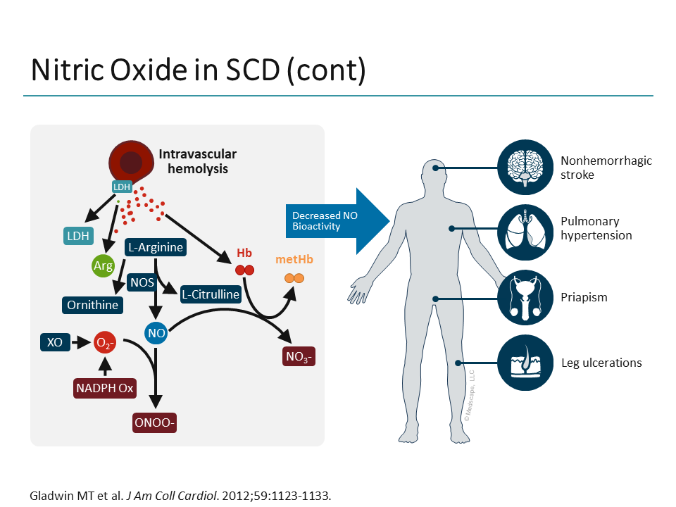 Updates On Sickle Cell Disease