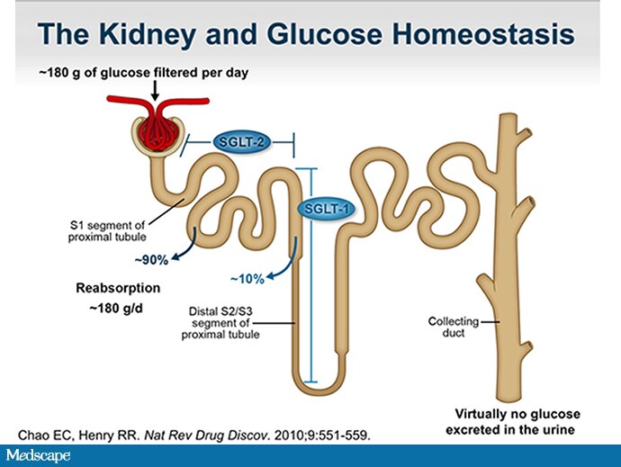 SGLT2, Fournier Gangrene Link Is to Do?