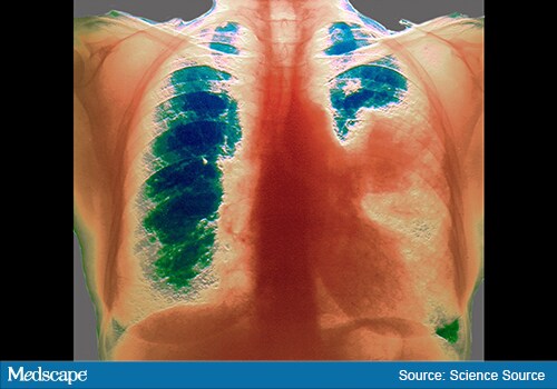 Fast Five Quiz: Non-Small Cell Lung Cancer - Page 2