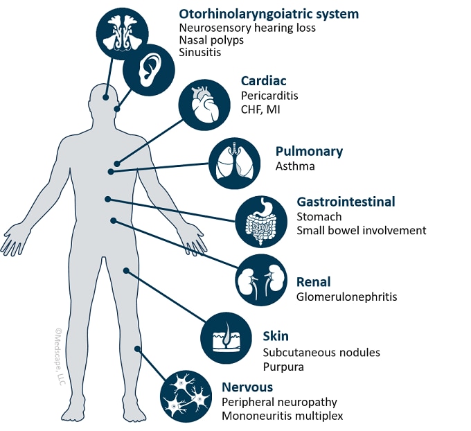 Clinical Challenge Series: Managing the Complex Patient With Adult ...