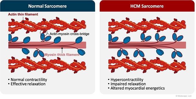 What’s New in HCM ? Assessing the Latest Evidence