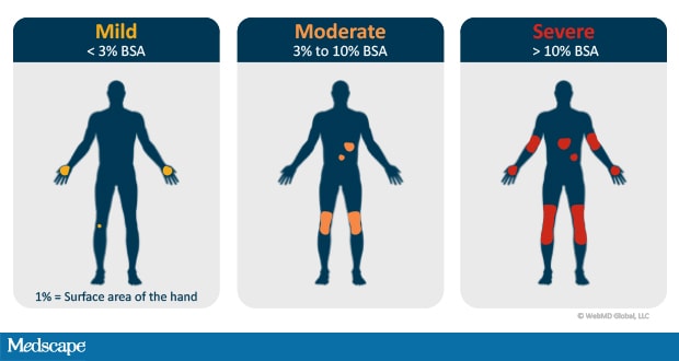 psoriasis measures of disease severity