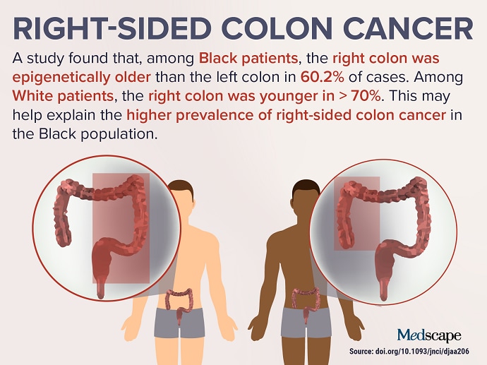 what increases colon cancer
