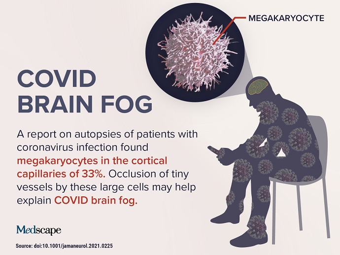 brain fog covid vaccine