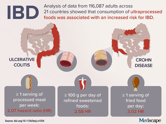 trending-clinical-topic-ibd