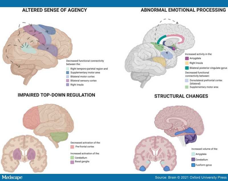 brain-neuroimaging-in-functional-movement-disorders