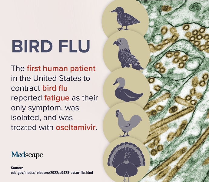 Trending Clinical Topic Bird Flu