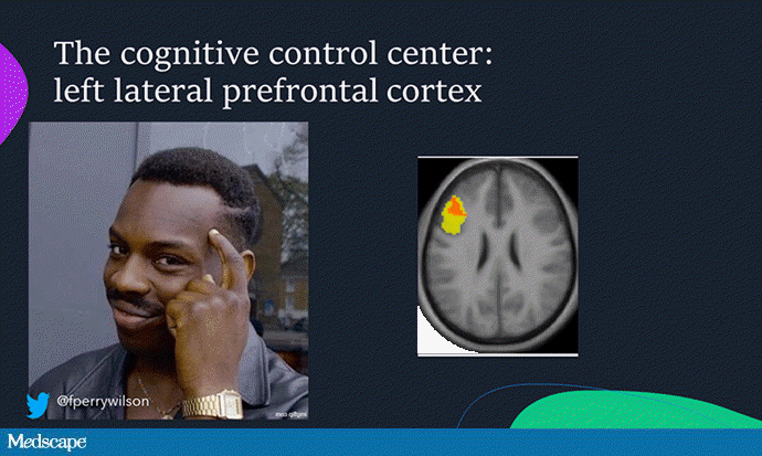 pre-frontal-cortex