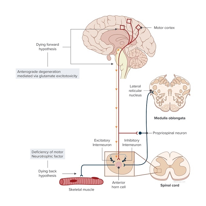 The Spectrum of Muscle Weakness in Amyotrophic Lateral Sclerosis: A ...