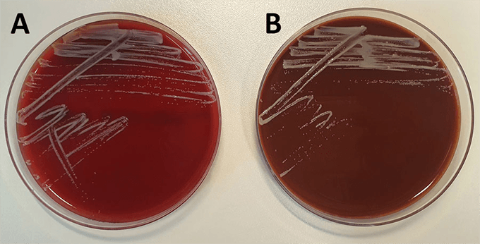 Enterococcus Faecium Vs. Faecalis En Agar Sangre PDF) Phenotypic And