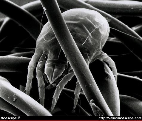 Asthma and the Challenges of House Dust Mite Management - Page 2