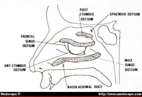 Sinusitis: Diagnosis and Treatment - Page 3